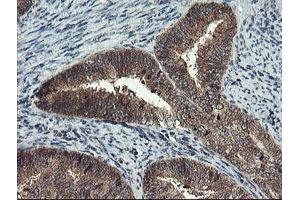 Image no. 2 for anti-Myeloid Leukemia Factor 1 (MLF1) antibody (ABIN1499496) (MLF1 antibody)