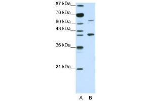 RARA antibody used at 1. (Retinoic Acid Receptor alpha antibody  (N-Term))