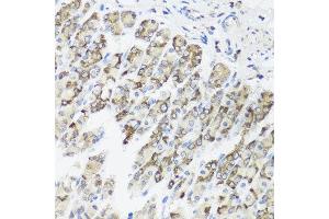 Immunohistochemistry of paraffin-embedded mouse stomach using TIMM10B antibody at dilution of 1:100 (x40 lens).