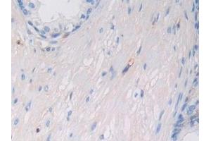 Detection of MHCC in Human Prostate Tissue using Polyclonal Antibody to Major Histocompatibility Complex Class I C (MHCC) (MHCC (AA 48-305) antibody)