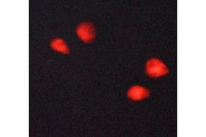 ABIN6269054 staining MCF-7 cells by ICC/IF. (HDAC3 antibody  (C-Term))