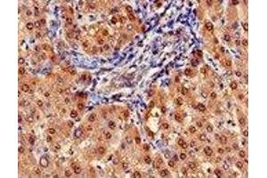 Immunohistochemistry (IHC) image for anti-Arginase, Liver (ARG1) (AA 1-322) antibody (ABIN6091459) (Liver Arginase antibody  (AA 1-322))