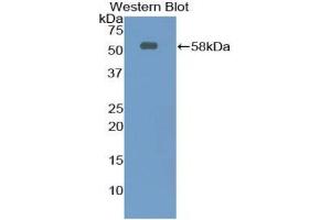 Detection of Recombinant Ntn1, Rat using Polyclonal Antibody to Netrin 1 (Ntn1) (Netrin 1 antibody  (AA 313-565))