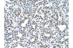 MCM3 antibody was used for immunohistochemistry at a concentration of 4-8 ug/ml to stain Alveolar cells (arrows) in Human Lung. (MCM3 antibody  (C-Term))