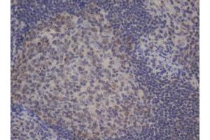Image no. 1 for anti-B-Cell CLL/lymphoma 10 (BCL10) antibody (ABIN1496848) (BCL10 antibody)
