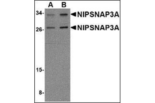 NIPSNAP3A antibody  (Center)