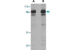Western blot analysis of SLITRK2 in rat brain tissue lysate with SLITRK2 polyclonal antibody  at (A) 1 and (B) 2 ug/mL . (SLITRK2 antibody  (C-Term))
