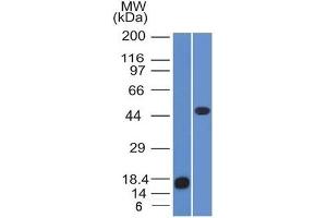 Western Blot of recombinant Adipophilin and Jurkat cell lysate using Adipophilin Mouse Monoclonal Antibody (ADFP/1365). (ADRP antibody  (AA 249-376))