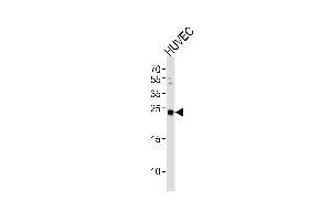 Western blot analysis of lysate from HUVEC cell line, using CSNK2B Antibody (ABIN391101 and ABIN2841237).