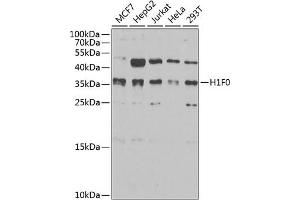 Western blot analysis of extracts of various cell lines, using Histone H1.