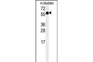 Western blot analysis in mouse bladder tissue lysates (15ug/lane). (ADSSL1 antibody  (N-Term))