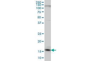 Western Blotting (WB) image for anti-C1D Nuclear Receptor Corepressor (C1D) (AA 1-142) antibody (ABIN599137) (C1D antibody  (AA 1-142))