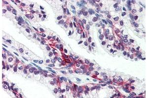 Anti-SLC39A6 antibody  ABIN1049338 IHC staining of human prostate. (SLC39A6 antibody  (Internal Region))