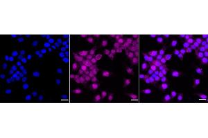 Immunocytochemical staining of HeLa cells with P70 S6 Kinase beta antibody (ABIN7800226), 1:1,000).