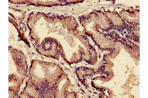 Immunohistochemistry of paraffin-embedded human prostate tissue using ABIN7159300 at dilution of 1:100 (MIA antibody  (AA 87-124))