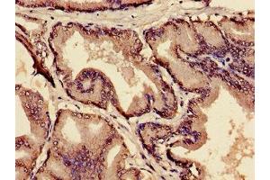 Immunohistochemistry of paraffin-embedded human prostate tissue using ABIN7159300 at dilution of 1:100
