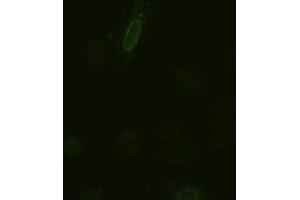 Anti-IL-6 mouse monoclonal antibody (ABIN2452353) immunofluorescent staining of HeLa cells transiently transfected by pCMV6-ENTRY IL-6 (RC202078) (IL-6 antibody  (AA 29-212))
