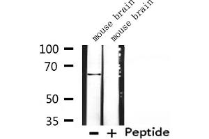 Western blot analysis of extracts from mouse brain, using K2C3 Antibody. (Keratin 3 antibody  (C-Term))