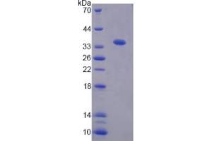 Image no. 1 for Tsukushin (TSKU) (AA 30-307) protein (His tag) (ABIN4990999)