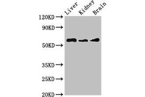 Western Blot Positive WB detected in: Mouse liver tissue, Mouse kidney tissue, Mouse brain tissue All lanes: CHRM5 antibody at 3. (CHRM5 antibody  (AA 220-427))