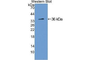 Detection of Recombinant TH, Rat using Polyclonal Antibody to Tyrosine Hydroxylase (TH) (Tyrosine Hydroxylase antibody  (AA 34-301))