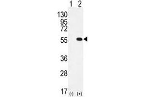 Western blot analysis of PRMT2 antibody and 293 cell lysate either nontransfected (Lane 1) or transiently transfected (2) with the PRMT2 gene. (PRMT2 antibody  (AA 344-375))