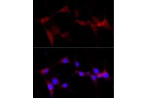 Immunofluorescence analysis of PC-12 cells using CYP1B1 antibody (ABIN3021930, ABIN3021931, ABIN3021932 and ABIN6217881) at dilution of 1:100 (40x lens). (CYP1B1 antibody  (AA 1-260))