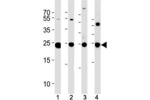 PGP 9. (UCHL1 antibody  (AA 187-214))