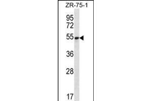 SEC62 Antibody (N-term) (ABIN656777 and ABIN2845996) western blot analysis in ZR-75-1 cell line lysates (35 μg/lane).