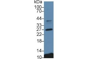 Detection of CTSS in Porcine Spleen lysate using Polyclonal Antibody to Cathepsin S (CTSS) (Cathepsin S antibody  (AA 115-331))
