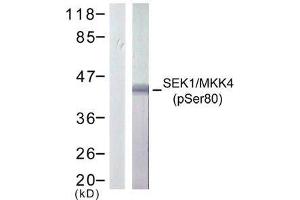 Western blot analysis of extract from 293 cells treated or untreated with UV, using SEK1/ MKK4 (phospho-Ser80) antibody (E011177). (MAP2K4 antibody  (pSer80))