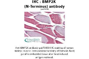 Image no. 2 for anti-BMP2 Inducible Kinase (BMP2K) (N-Term) antibody (ABIN1732361) (BMP2K antibody  (N-Term))