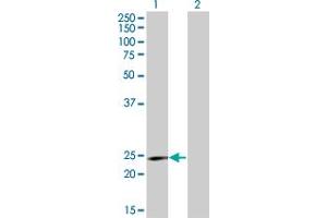 Western Blot analysis of RCV1 expression in transfected 293T cell line by RCV1 monoclonal antibody (M06), clone 4D9. (Recoverin antibody  (AA 101-199))