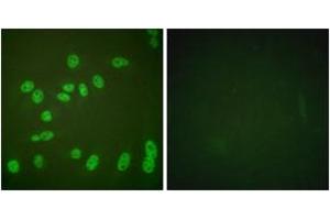 Immunofluorescence analysis of HeLa cells treated with PMA 125ng/ml 30', using POLR2A (Phospho-Ser1619) Antibody. (POLR2A/RPB1 antibody  (pSer1619))