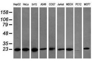 Image no. 6 for anti-Prefoldin Subunit 3 (PFDN3) antibody (ABIN1501707) (VBP1 antibody)