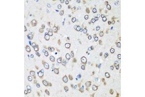 Immunohistochemistry of paraffin-embedded rat brain using EEF1G antibody. (EEF1G antibody  (AA 168-437))