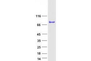 Western Blotting (WB) image for Debranching Enzyme Homolog 1 (DBR1) protein (Myc-DYKDDDDK Tag) (ABIN2719238)