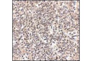 Immunohistochemistry of RSPO1 in human spleen tissue with this product at 2.