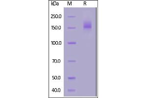 Human CEACAM-5, Fc Tag on  under reducing (R) condition. (CEACAM5 Protein (AA 35-685) (Fc Tag))