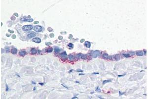 Human Ovary: Formalin-Fixed, Paraffin-Embedded (FFPE) (ENPP3 antibody  (Internal Region))