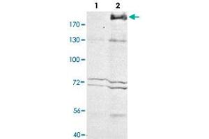 Western blot analysis of Mrc1 in whole cell extracts. (Macrophage Mannose Receptor 1 antibody)