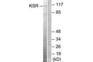 Western blot analysis of extracts from NIH-3T3 cells, treated with PDGF 50ng/ml 20', using KSR (Ab-392) Antibody. (KSR1 antibody  (AA 358-407))