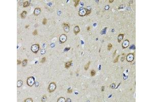 Immunohistochemistry of paraffin-embedded Rat brain using RPS10 Polyclonal Antibody at dilution of 1:100 (40x lens). (RPS10 antibody)