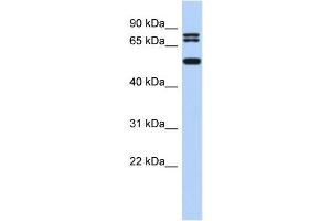 WB Suggested Anti-LASS4 Antibody Titration:  0.