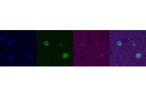 Immunohistochemistry (IHC) image for anti-Calbindin (CALB1) antibody (ABIN7456109) (CALB1 antibody)