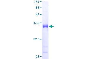 SPRR3 Protein (AA 1-161) (GST tag)