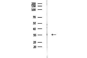 anti-Fructosamine 3 Kinase (FN3K) (Internal Region) antibody