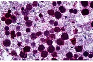 Human Testis: Formalin-Fixed, Paraffin-Embedded (FFPE) (FADS1 antibody  (AA 1-100))