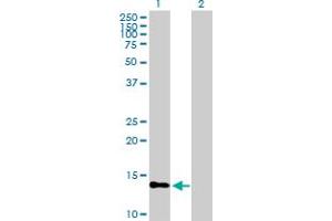 PTS antibody  (AA 1-145)