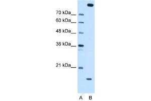 WB Suggested Anti-CTAGE5 Antibody Titration:  0. (MIA2 antibody  (Middle Region))